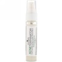 Zion Health, 古代のクレイ・ナチュラルソープ、マウンテンレイン（山の雨）、6オンス（170 g） (Discontinued Item)